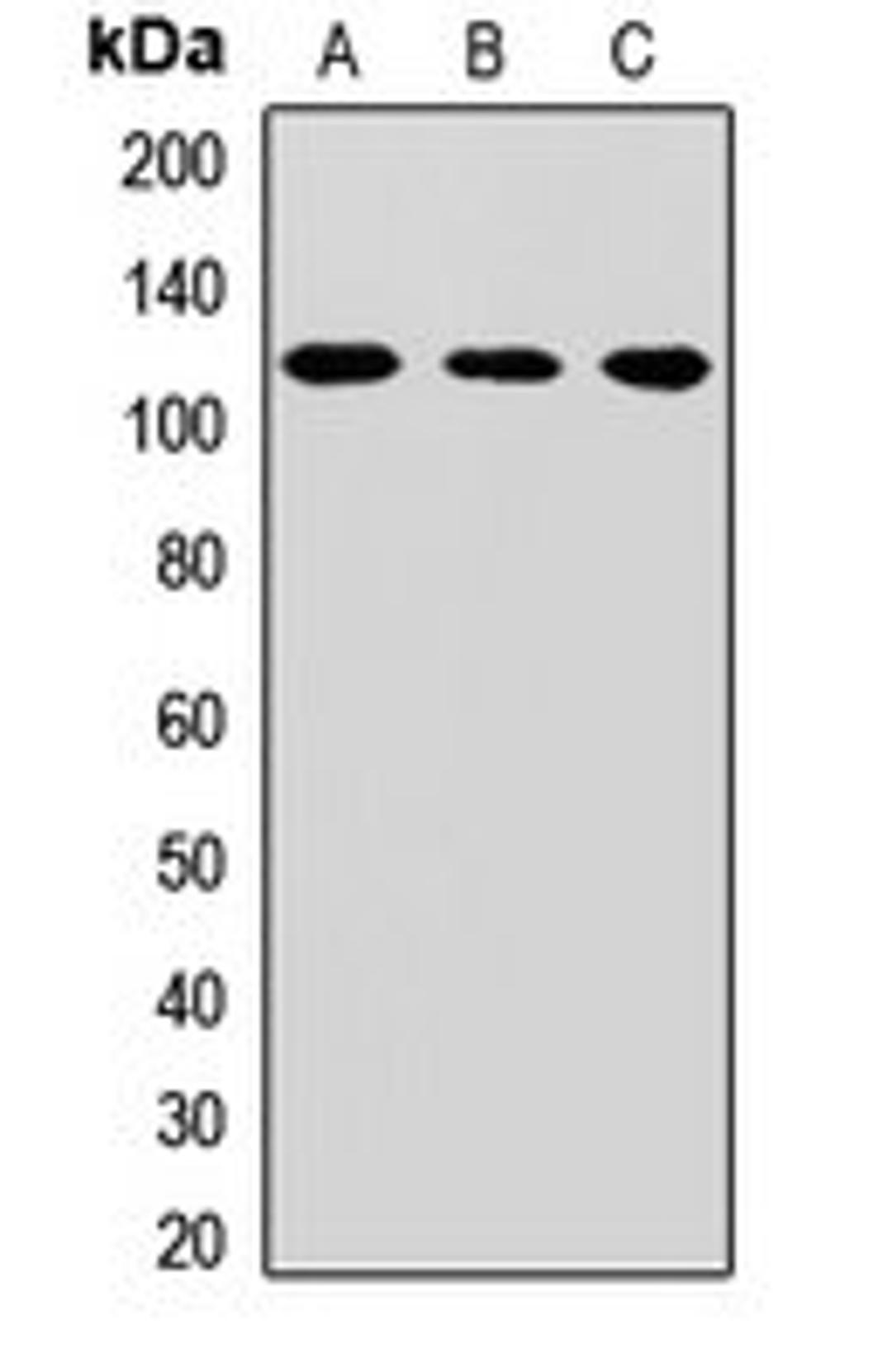 Western blot analysis of Hela (Lane1), mouse liver (Lane2), rat kidney (Lane3) whole cell lysates using CPSF2 antibody