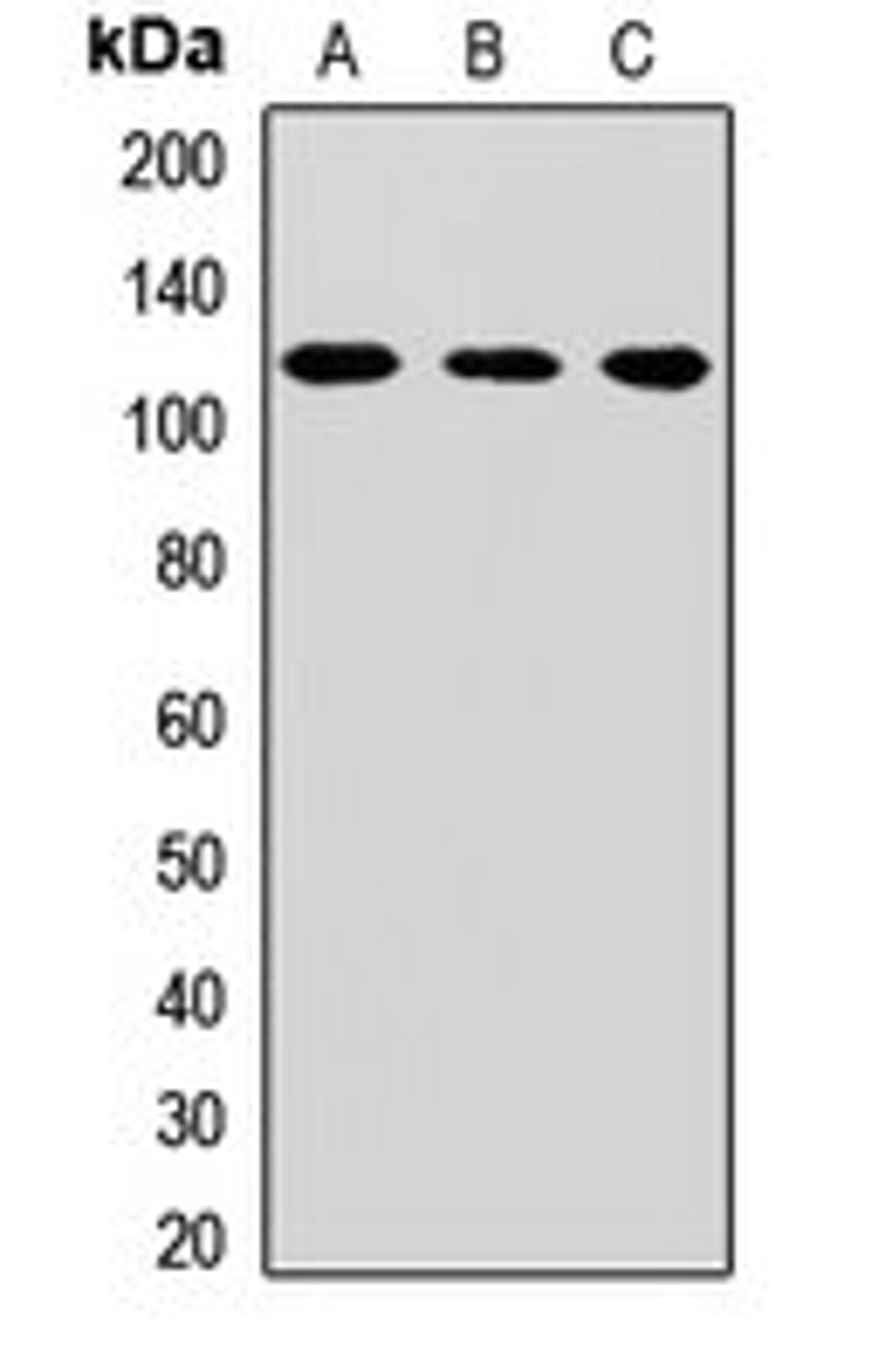 Western blot analysis of Hela (Lane1), mouse liver (Lane2), rat kidney (Lane3) whole cell lysates using CPSF2 antibody