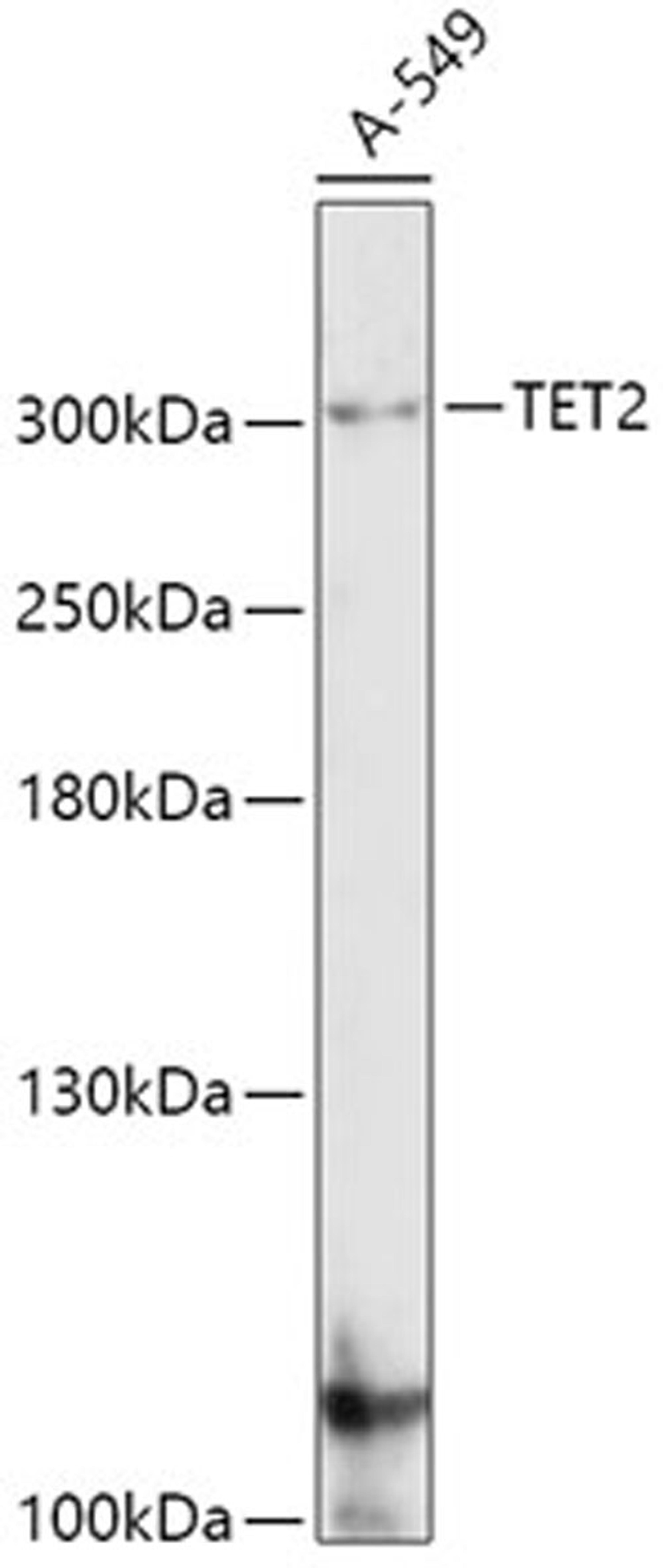 Western blot - TET2 antibody (A5682)