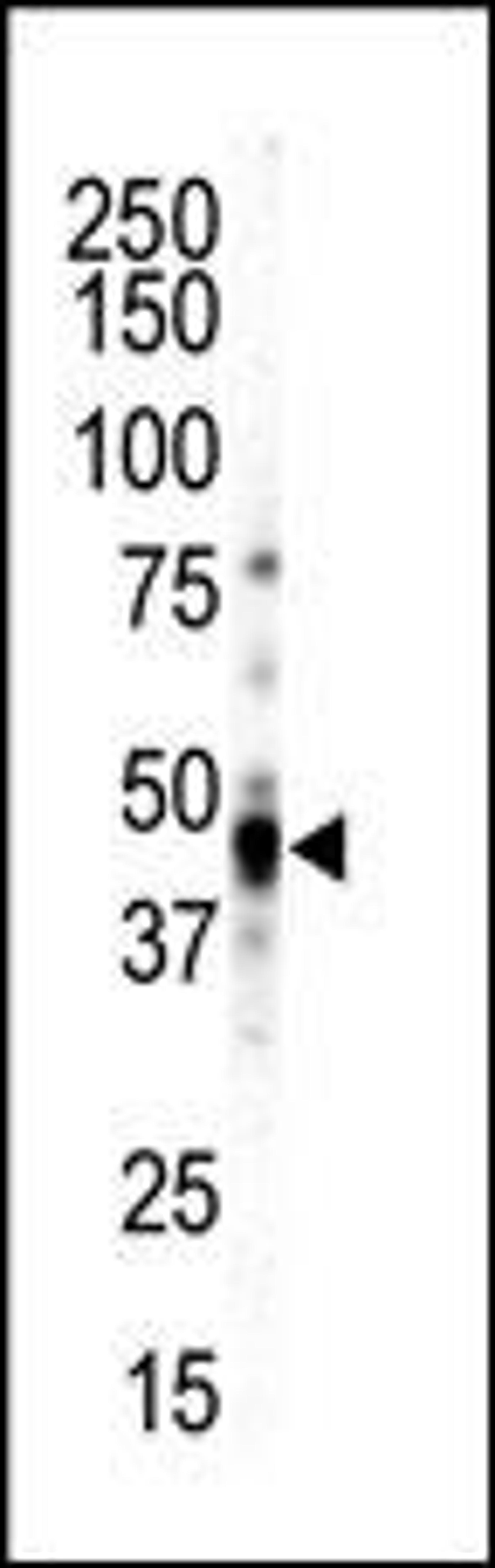 Western blot analysis of anti-CAMK1-like C-term Pab in NCIH460 cell lysate. CAMK1-like was detected using purified Pab.