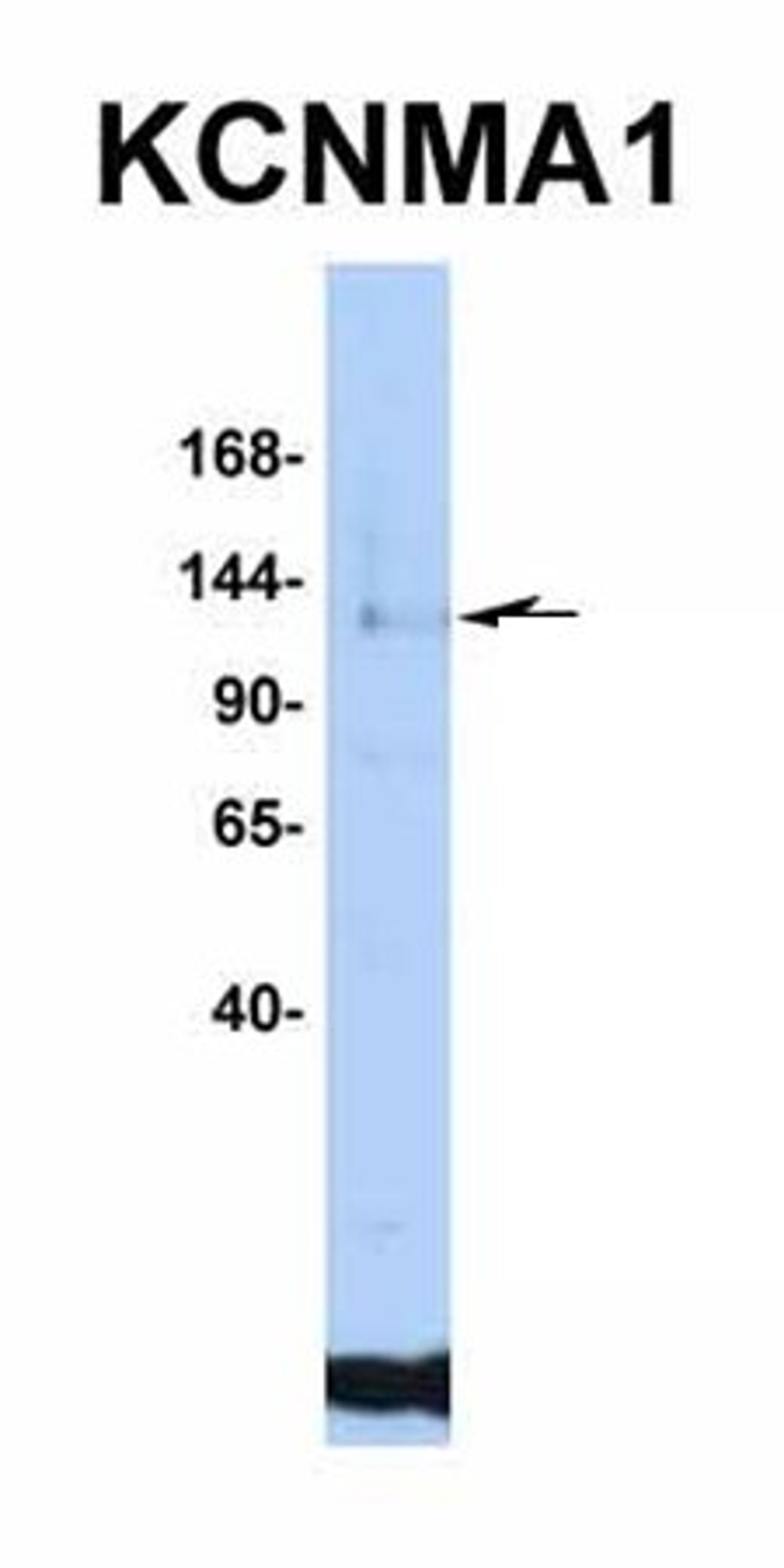 Western blot analysis of human Jurkat tissue using KCNMA1 antibody