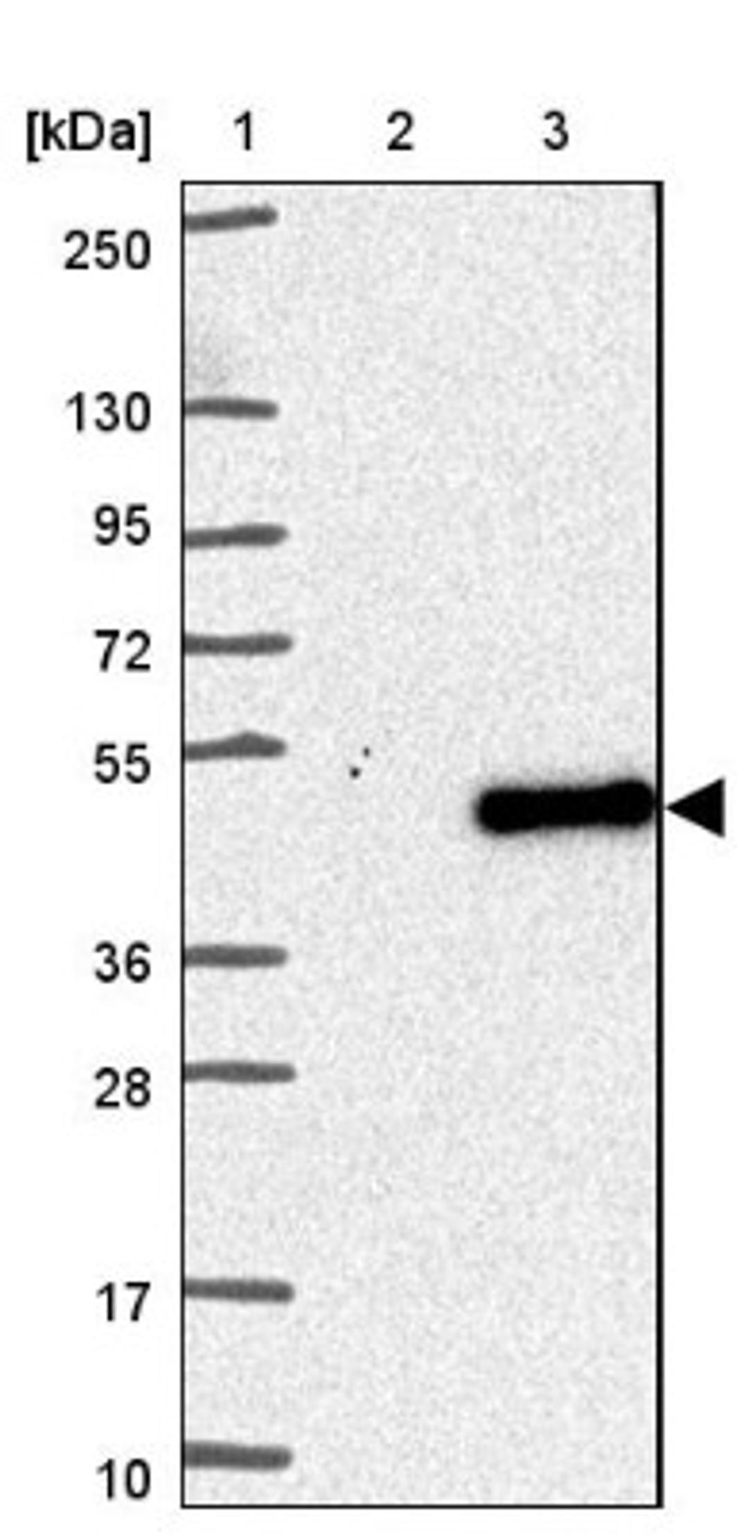 Western Blot: FAM181A Antibody [NBP1-90730] - Lane 1: Marker [kDa] 250, 130, 95, 72, 55, 36, 28, 17, 10<br/>Lane 2: Negative control (vector only transfected HEK293T lysate)<br/>Lane 3: Over-expression lysate (Co-expressed with a C-terminal myc-DDK tag (~3.1 kDa) in mammalian HEK293T cells, LY408610)