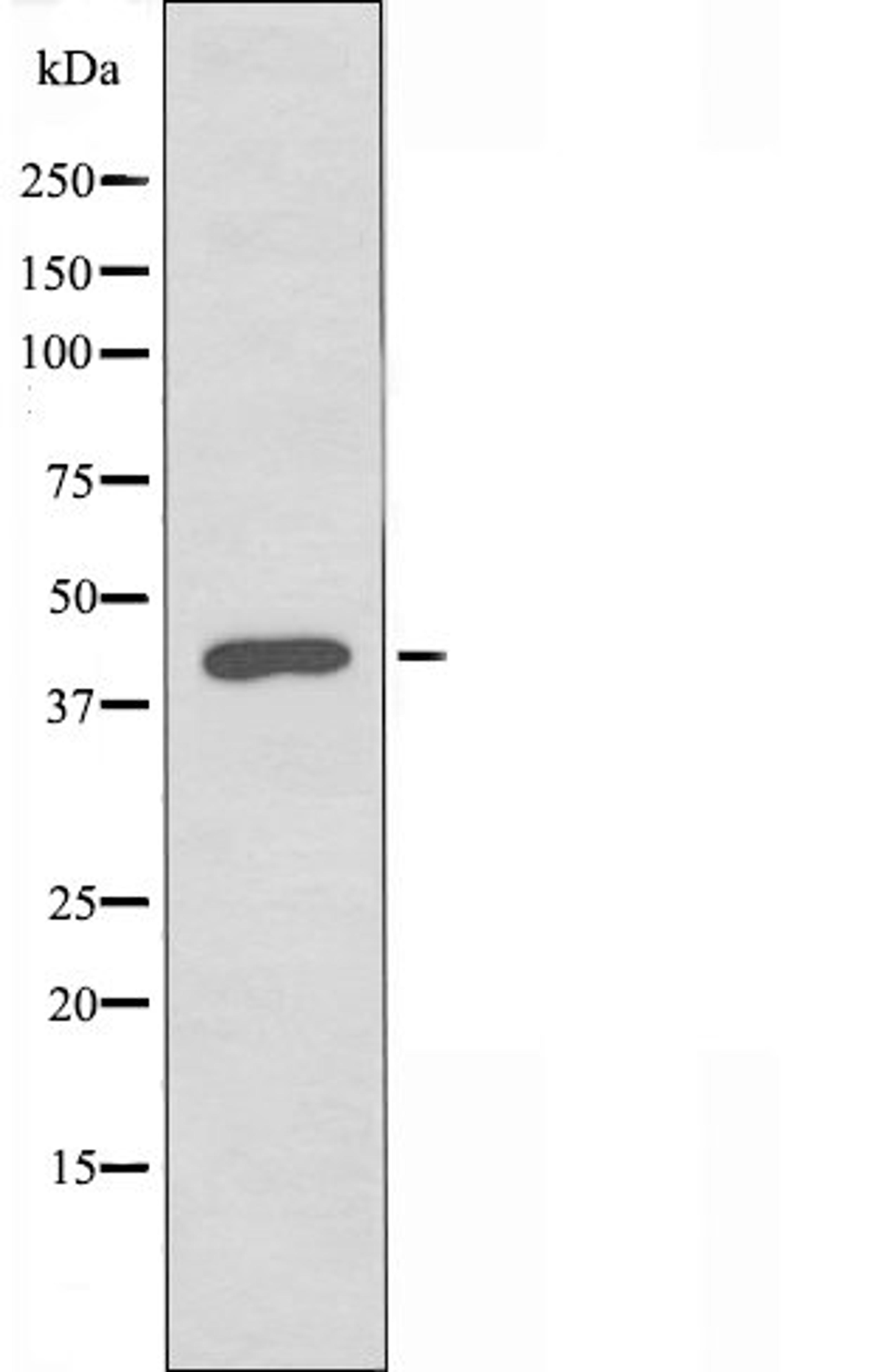 Western blot analysis of Jurkat cells using Serpin A5 antibody