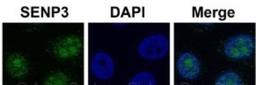 Immunohistochemistry: SENP3 Antibody [NBP1-56590] - HeLa cells using Immunohistochemistry. SENP3 is strongly supported by BioGPS gene expression data to be expressed in HeLa.