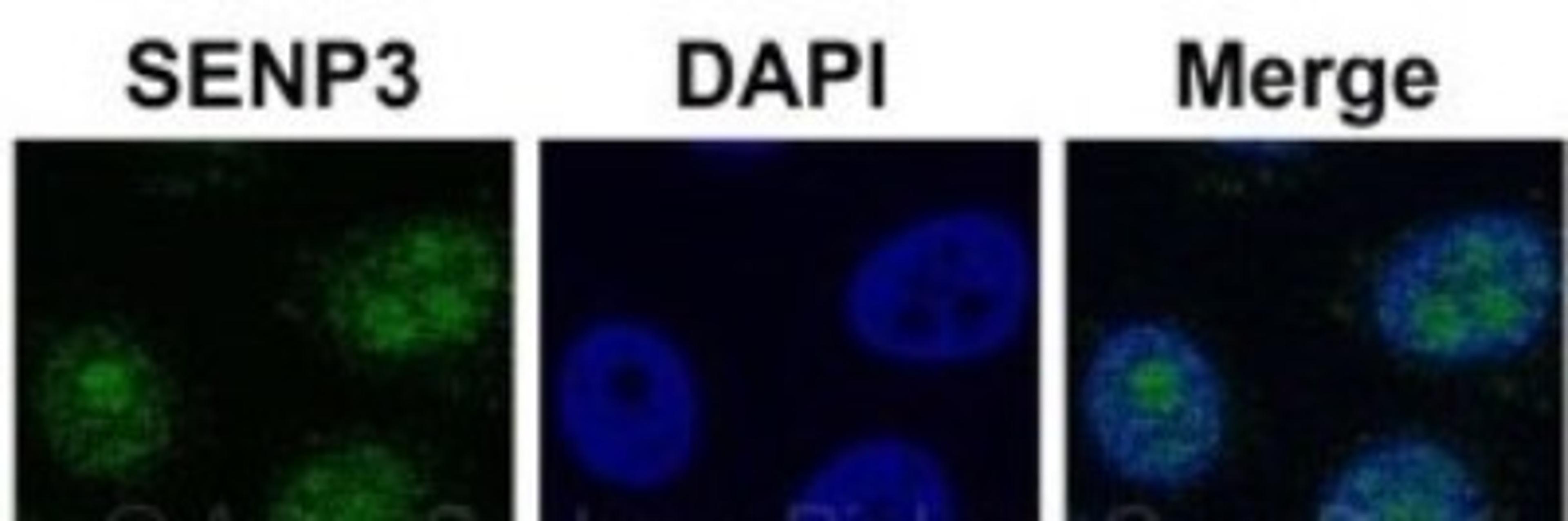 Immunohistochemistry: SENP3 Antibody [NBP1-56590] - HeLa cells using Immunohistochemistry. SENP3 is strongly supported by BioGPS gene expression data to be expressed in HeLa.