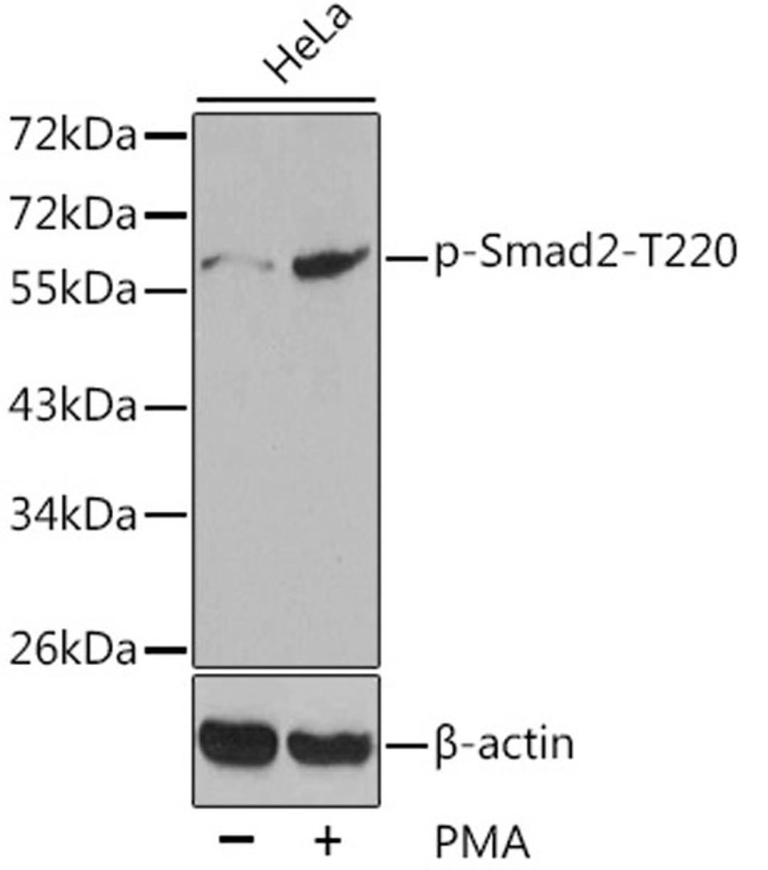 Western blot - Phospho-Smad2-T220 antibody (AP0270)