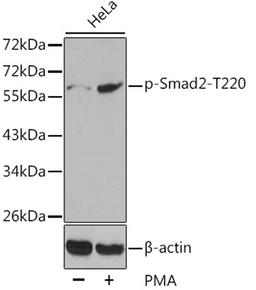 Western blot - Phospho-Smad2-T220 antibody (AP0270)