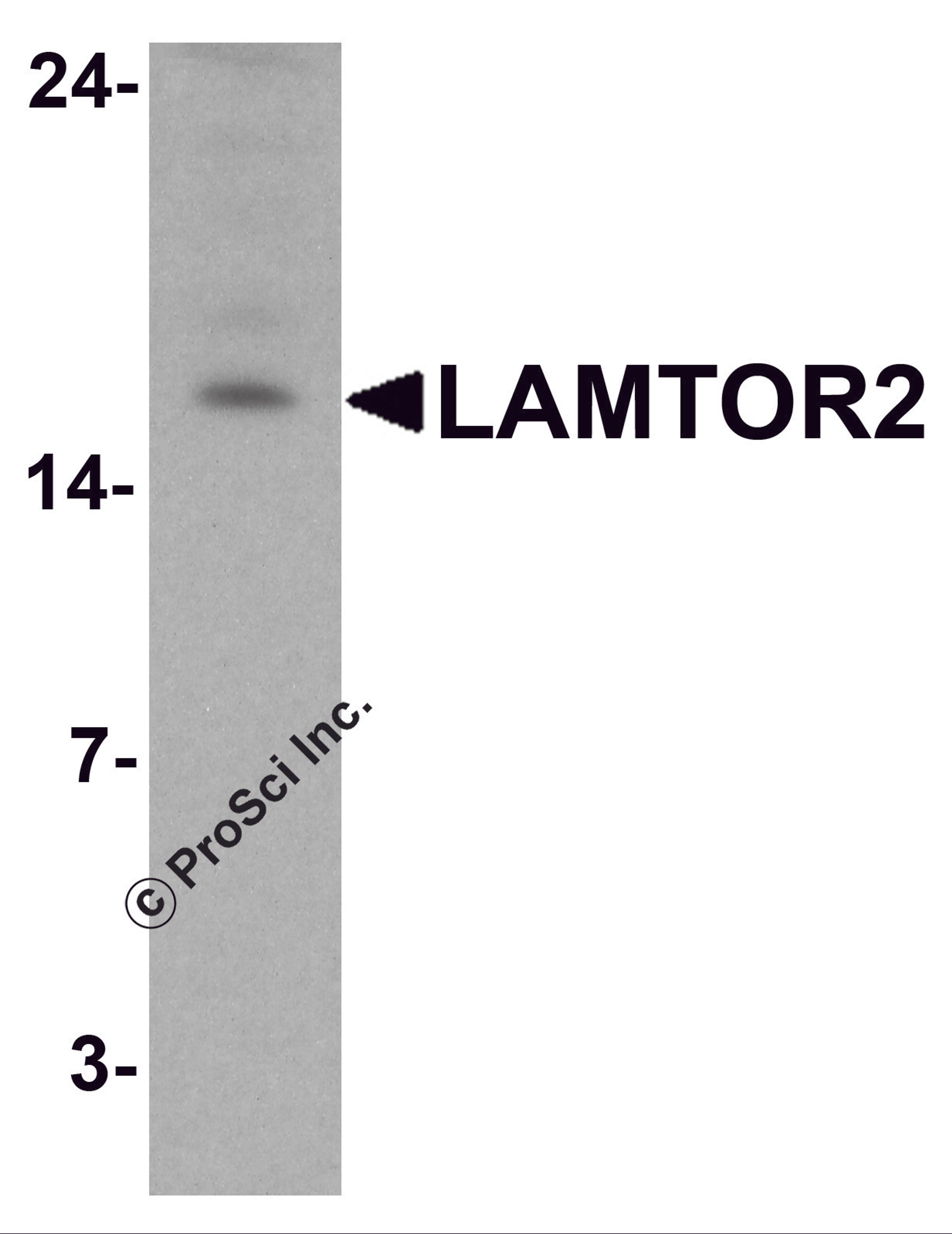 Western blot analysis of LAMTOR2 in HepG2 cell lysate with LAMTOR2 antibody at 1 &#956;g/ml.