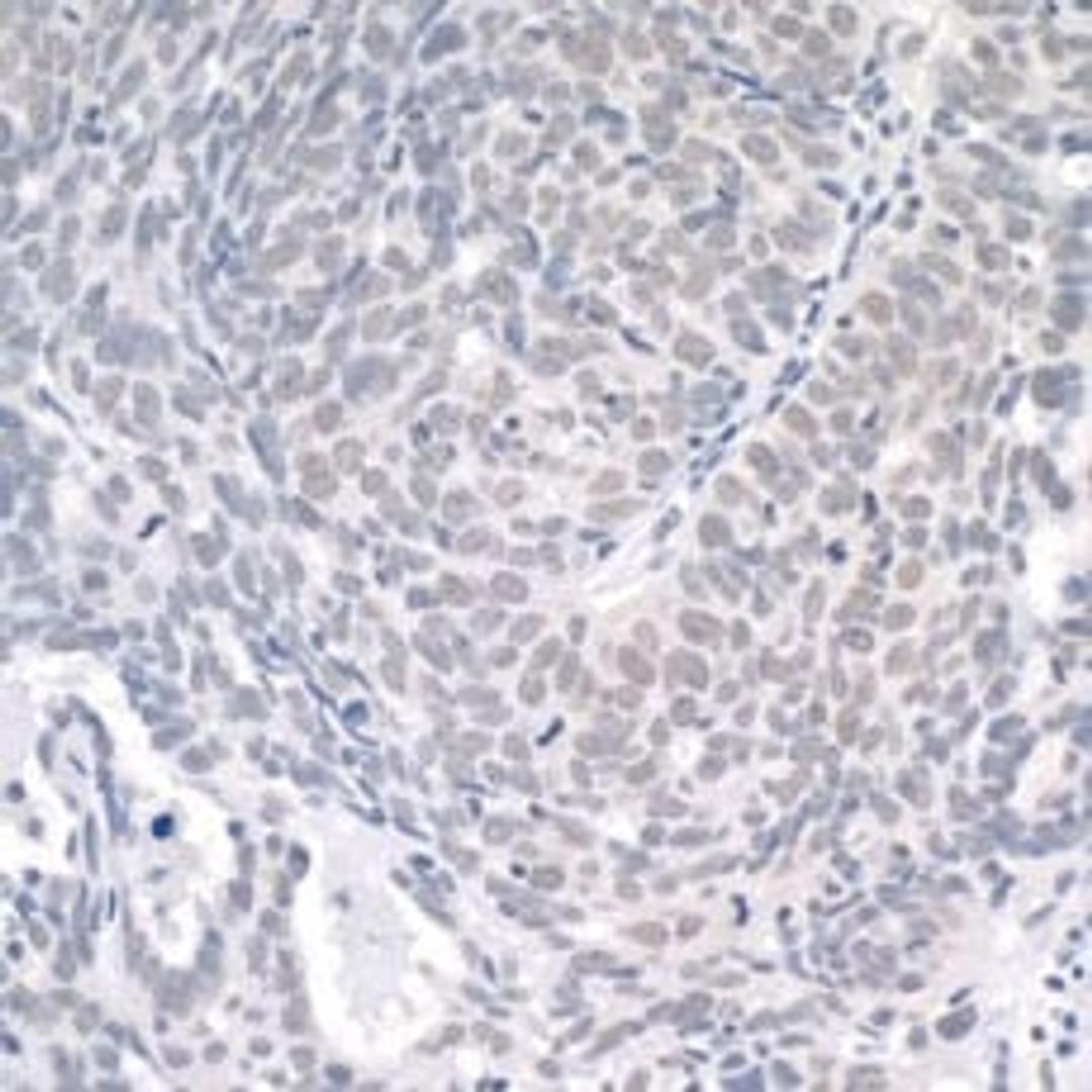 Detection of human USP1 by immunohistochemistry.