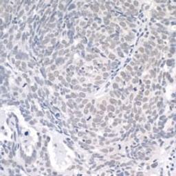 Detection of human USP1 by immunohistochemistry.