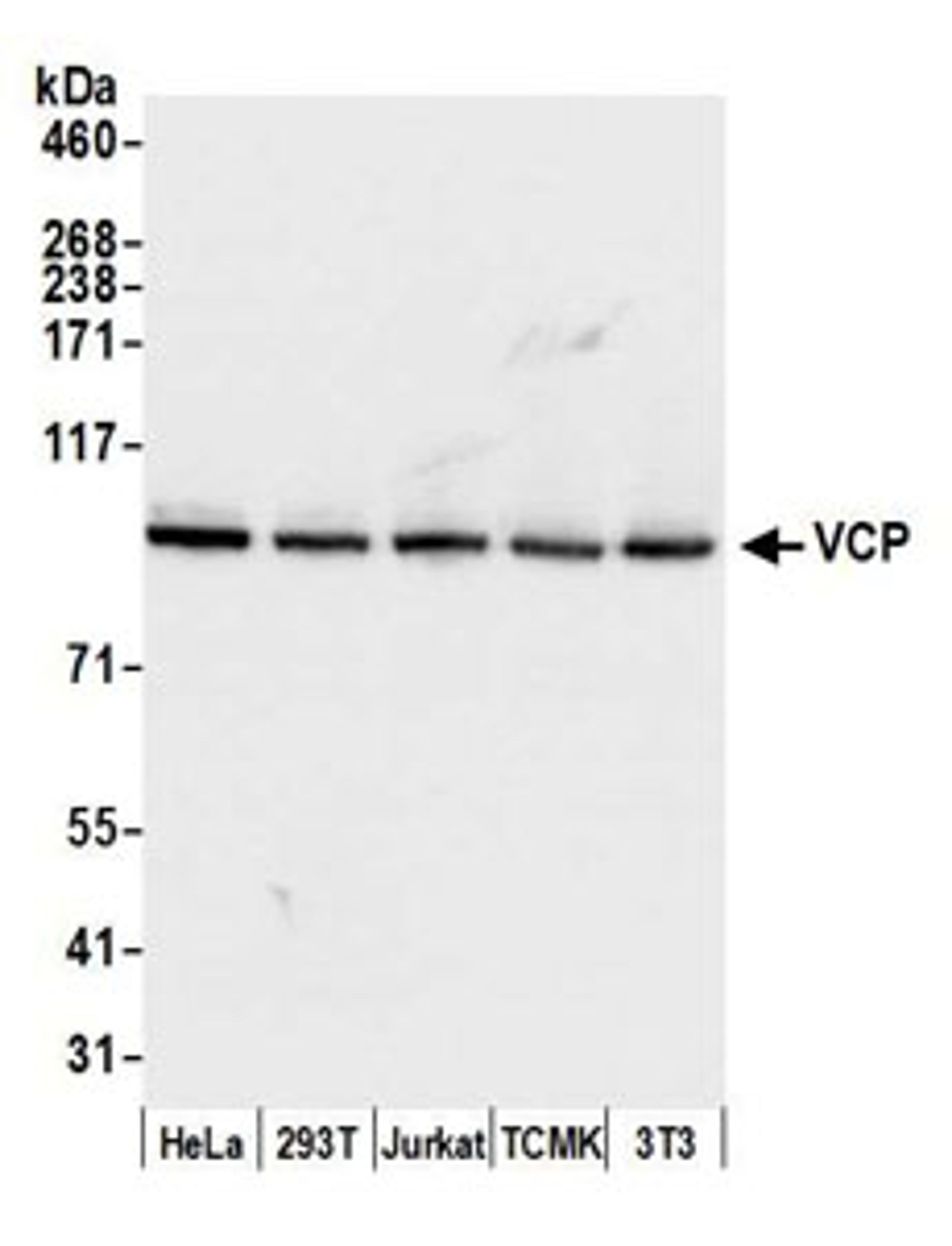 Detection of human and mouse VCP by western blot.