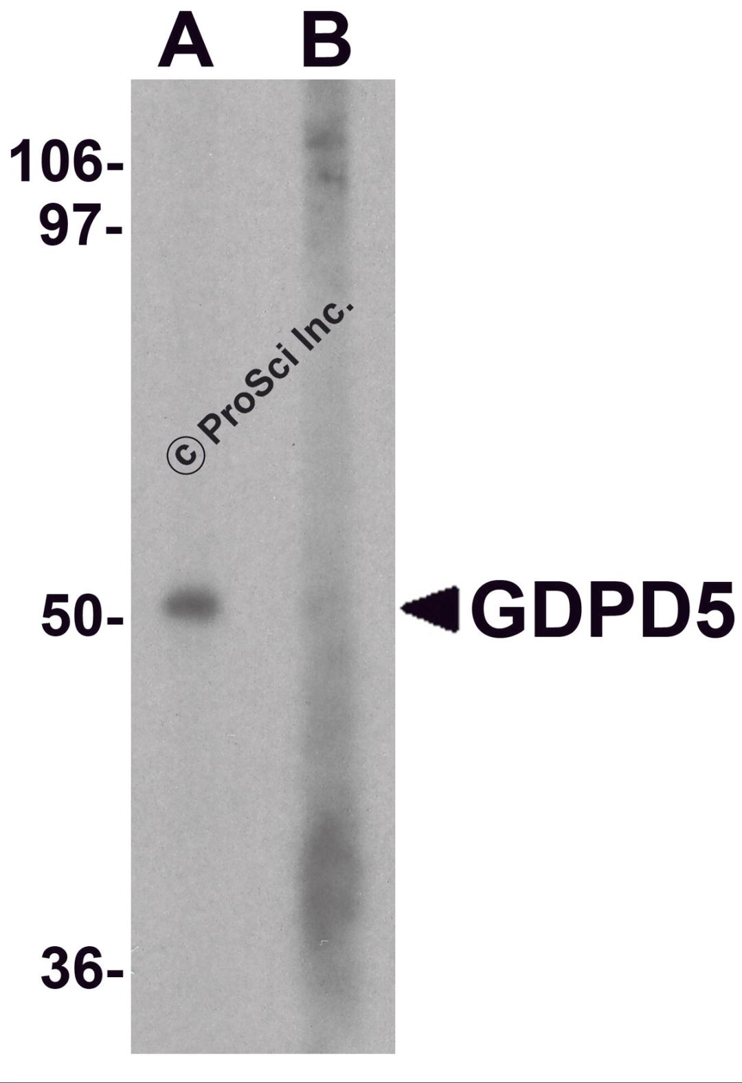Western blot analysis of GDPD5 in mouse kidney tissue lysate with GDPD5 antibody at 1 μg/ml in (A) the absence and (B) the presence of blocking peptide.