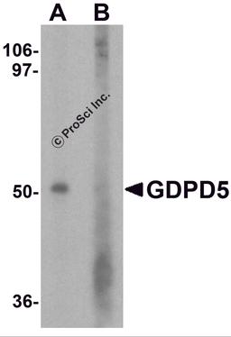 Western blot analysis of GDPD5 in mouse kidney tissue lysate with GDPD5 antibody at 1 μg/ml in (A) the absence and (B) the presence of blocking peptide.