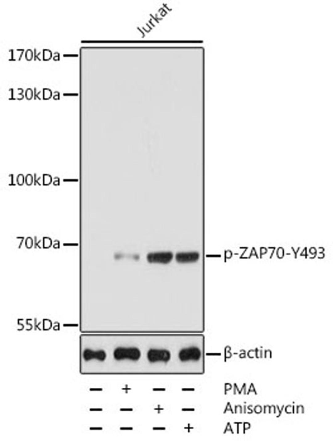 Western blot - Phospho-ZAP70-Y493 pAb (AP0468)