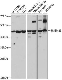 Western blot - TMEM25 antibody (A14370)