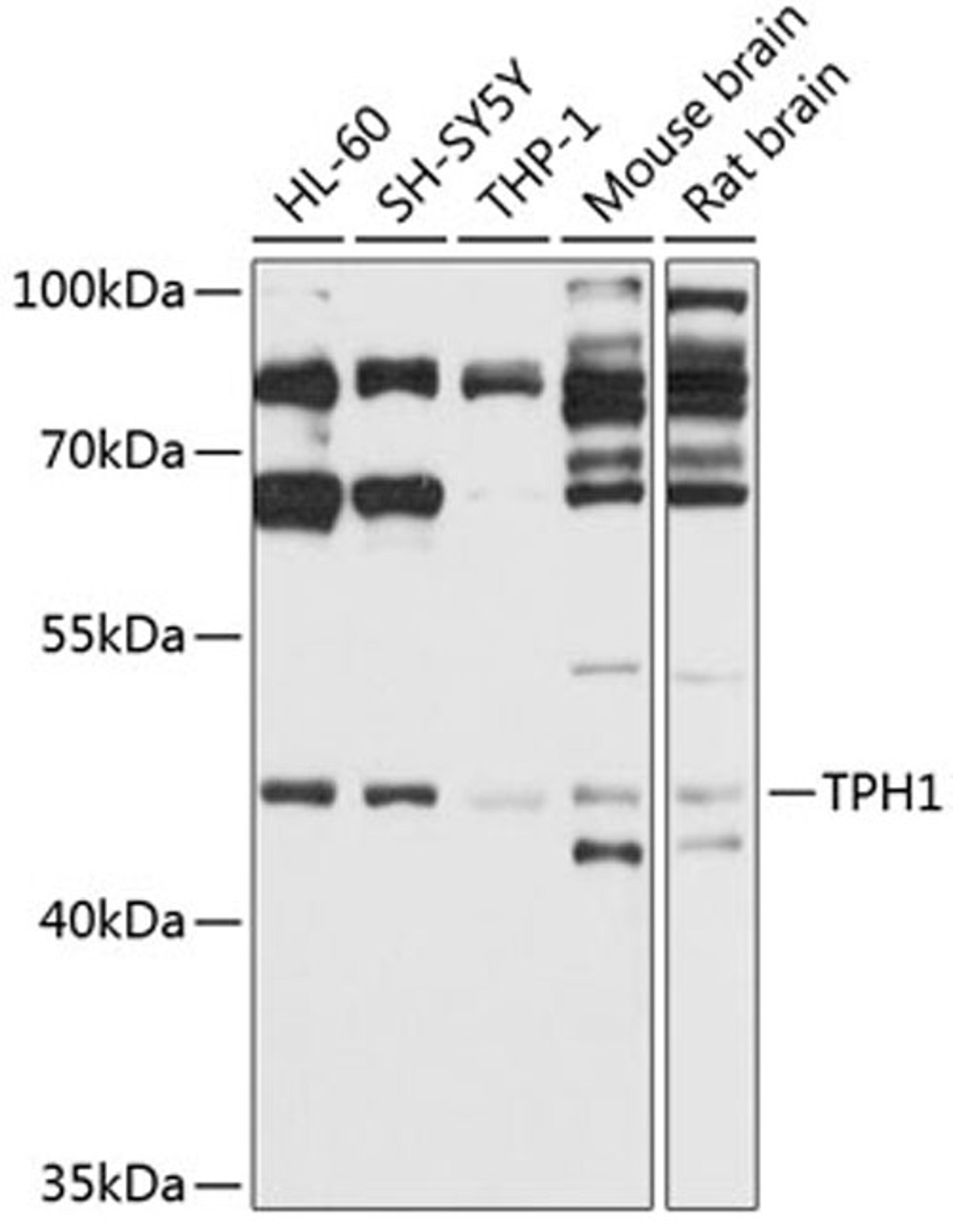 Western blot - TPH1 antibody (A1569)