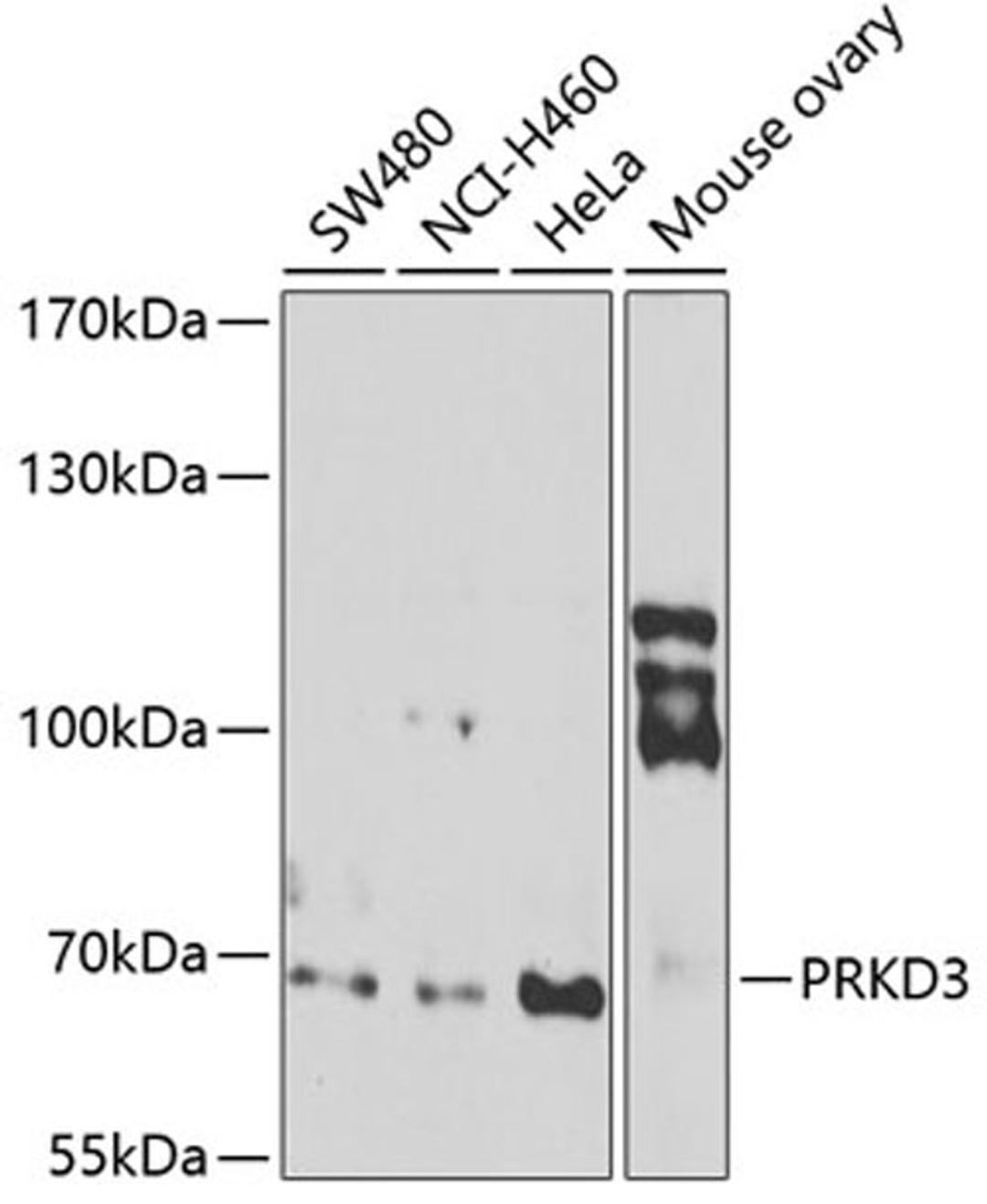 Western blot - PRKD3 antibody (A7084)