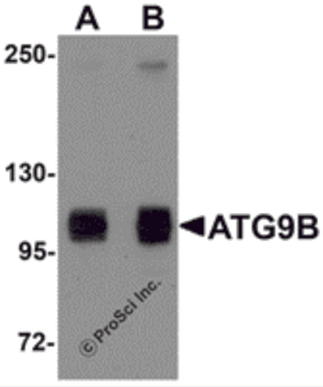 Western blot analysis of ATG9B in HeLa cell lysate with ATG9B antibody at (A) 1 and (B) 2 μg/mL.