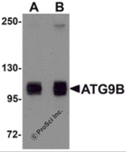 Western blot analysis of ATG9B in HeLa cell lysate with ATG9B antibody at (A) 1 and (B) 2 μg/mL.