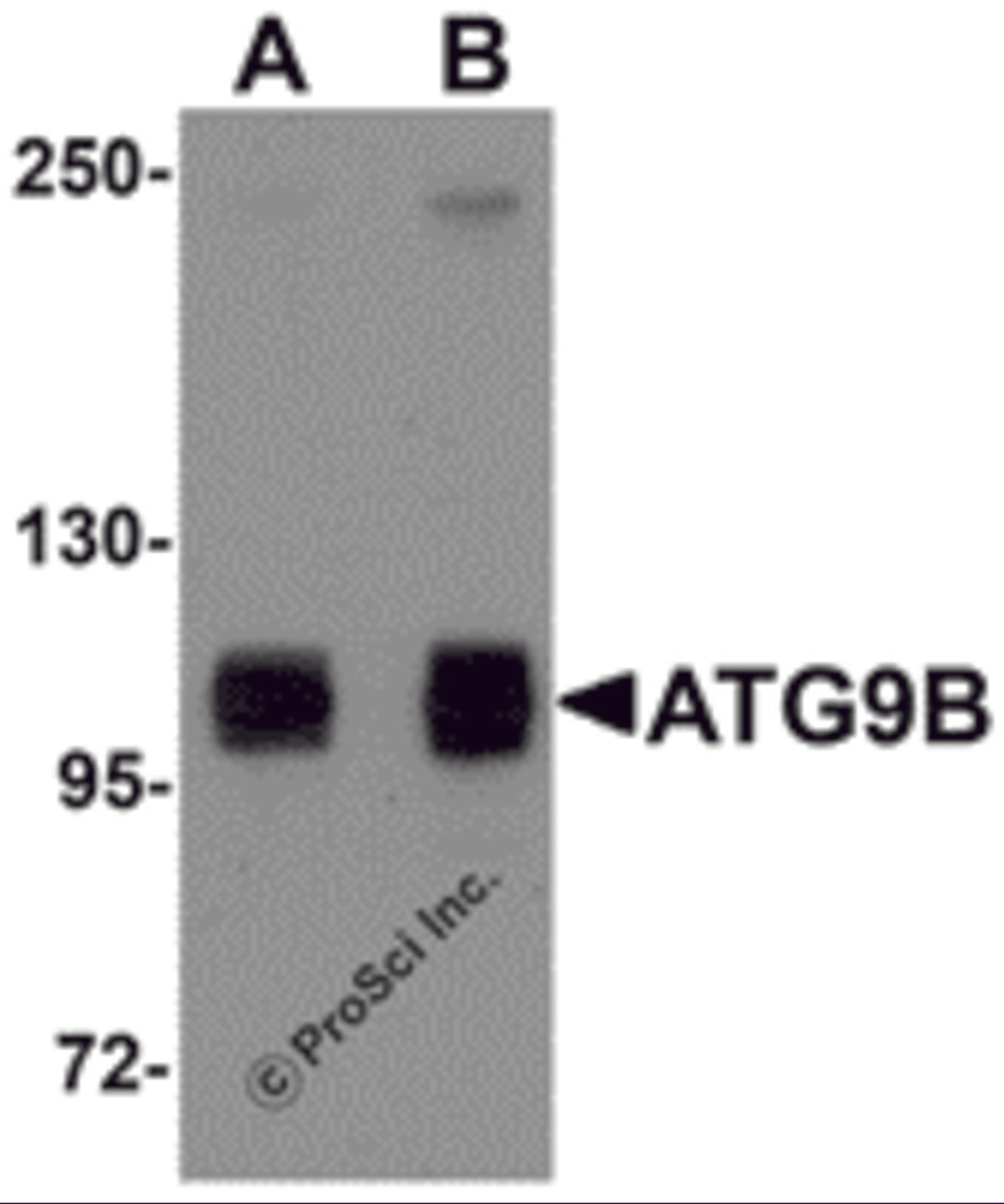 Western blot analysis of ATG9B in HeLa cell lysate with ATG9B antibody at (A) 1 and (B) 2 μg/mL.