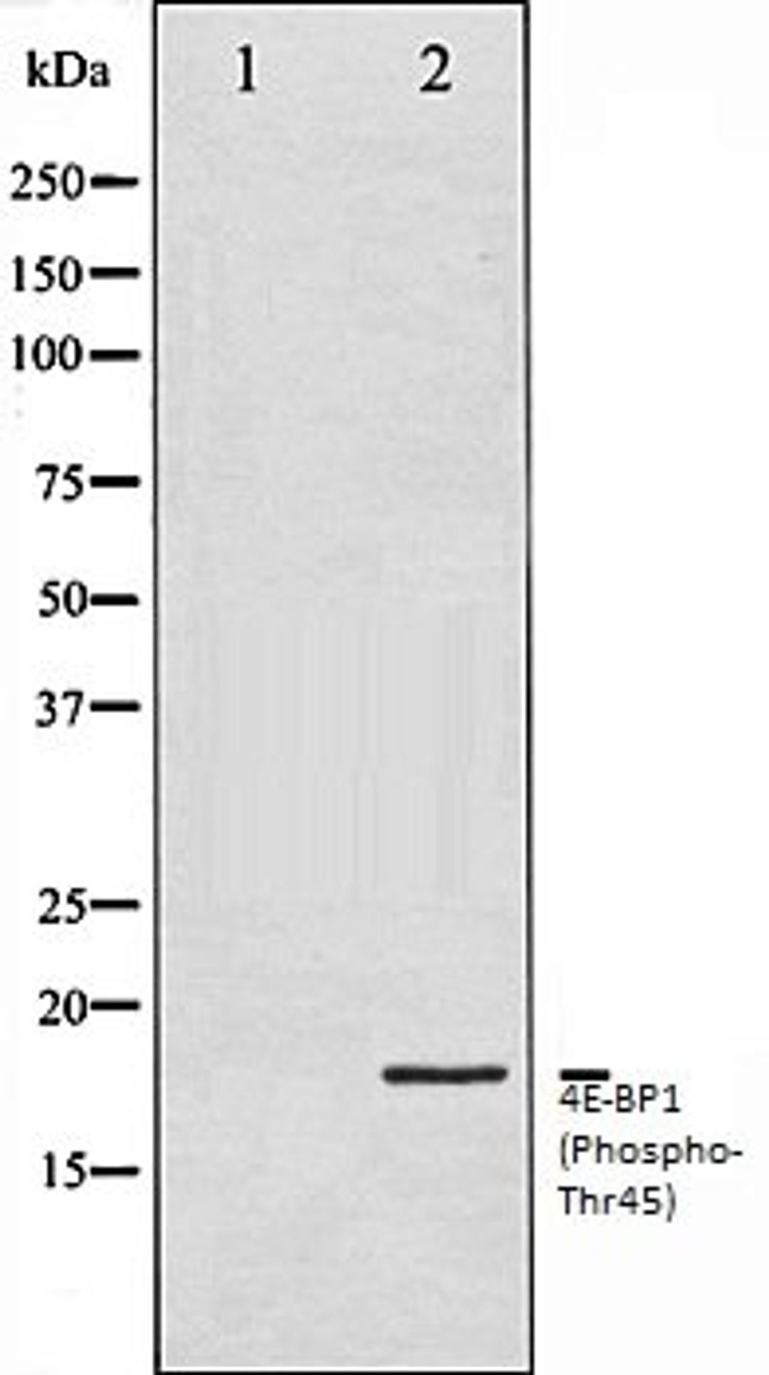 Western blot analysis of MDA-MB-435 whole cell lysates using 4E-BP1 (Phospho-Thr45) antibody, The lane on the left is treated with the antigen-specific peptide.