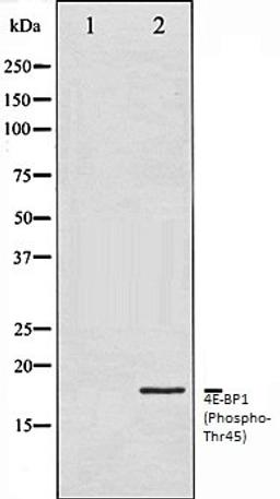 Western blot analysis of MDA-MB-435 whole cell lysates using 4E-BP1 (Phospho-Thr45) antibody, The lane on the left is treated with the antigen-specific peptide.