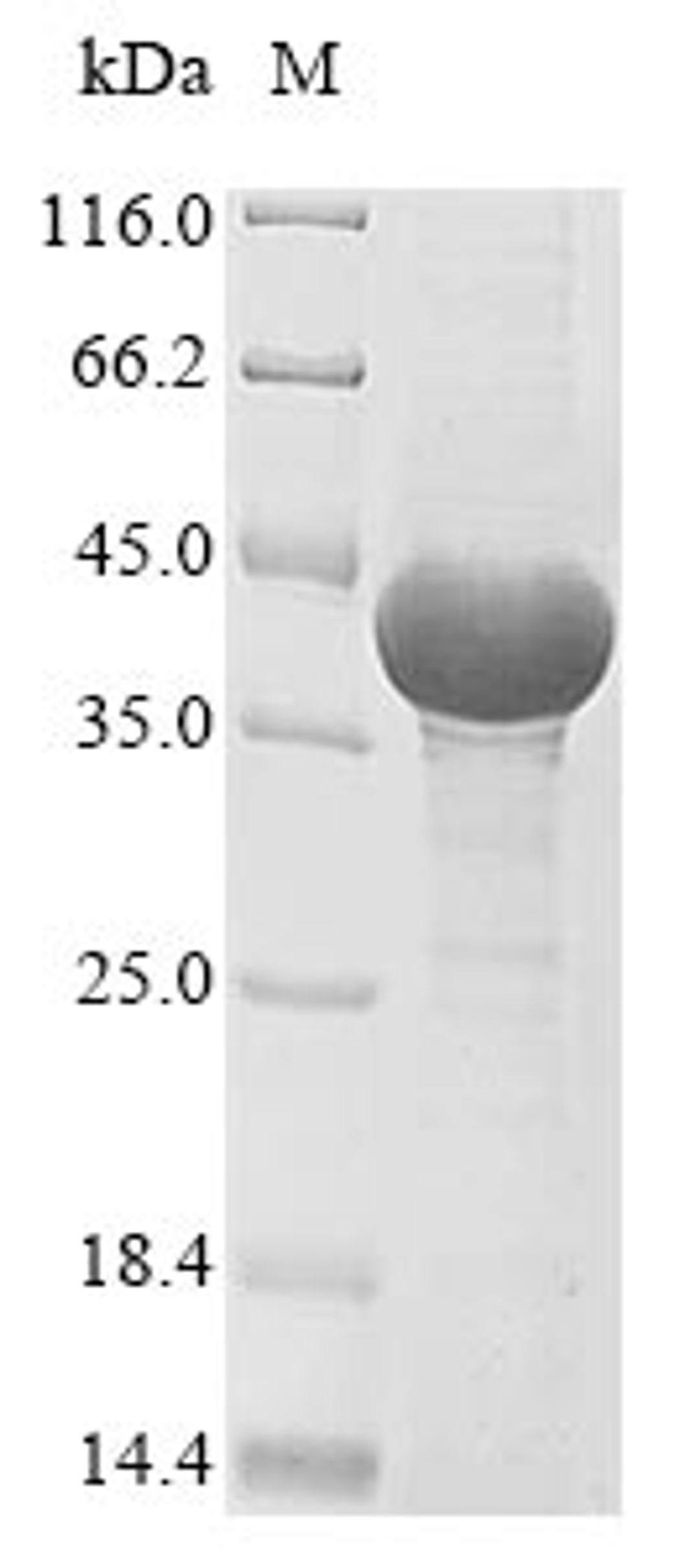 (Tris-Glycine gel) Discontinuous SDS-PAGE (reduced) with 5% enrichment gel and 15% separation gel.
