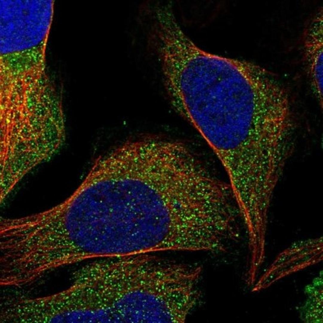 Immunocytochemistry/Immunofluorescence: RPIP8 Antibody [NBP1-80855] - staining of human cell line U-2 OS shows positivity in vesicles.