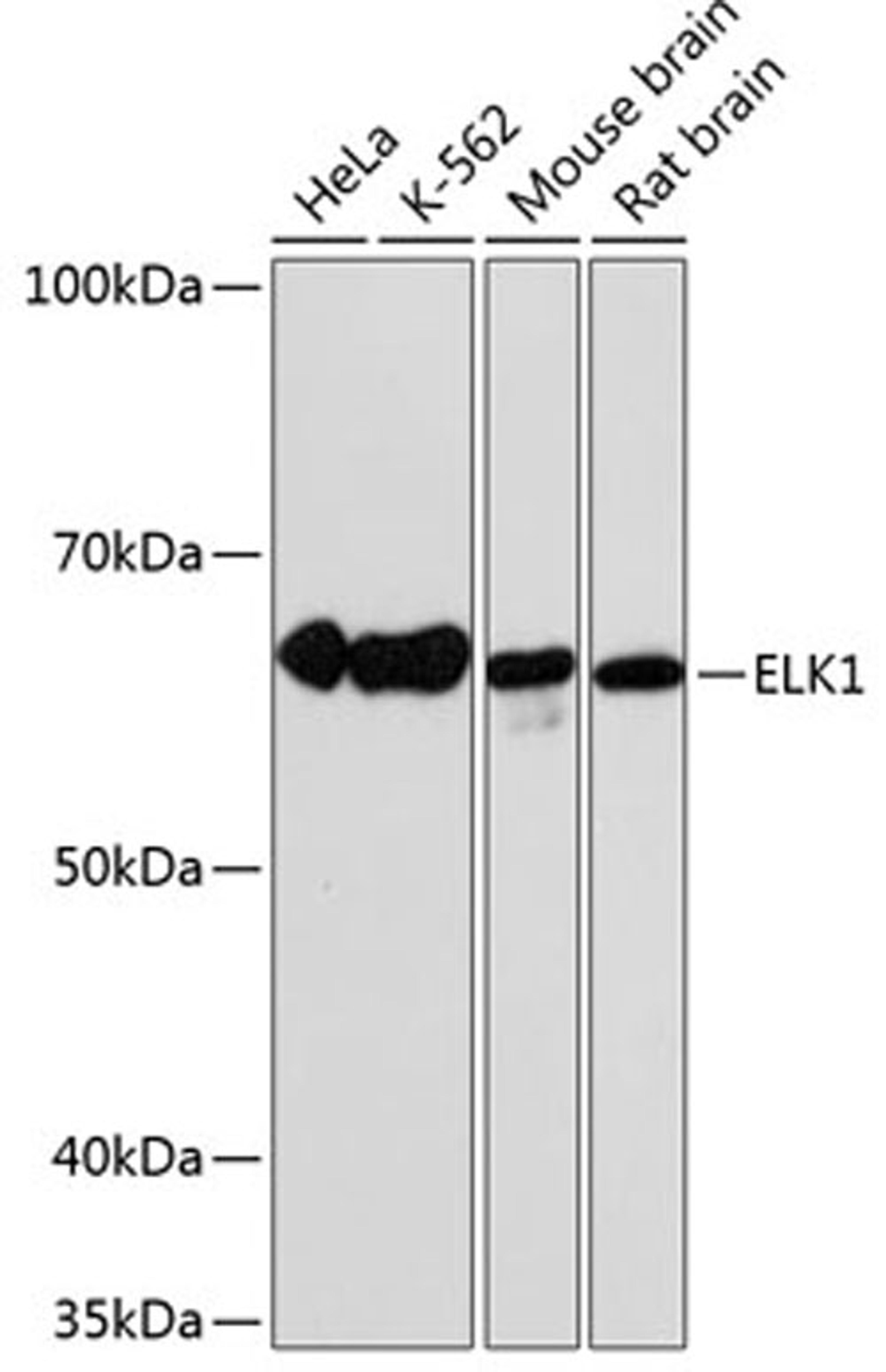 Western blot - ELK1 antibody (A19046)