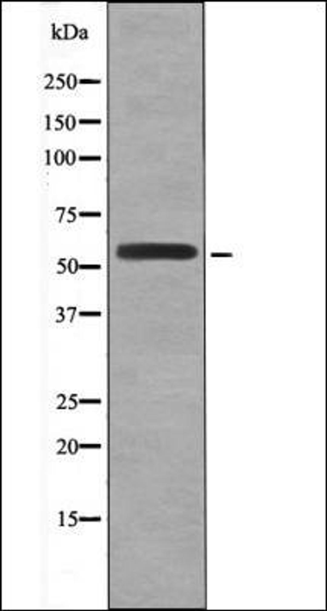 Western blot analysis of UV treated Jurkat whole cell lysates using HSF1 -Phospho-Ser307- antibody