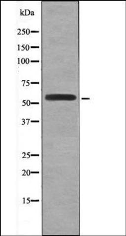 Western blot analysis of UV treated Jurkat whole cell lysates using HSF1 -Phospho-Ser307- antibody