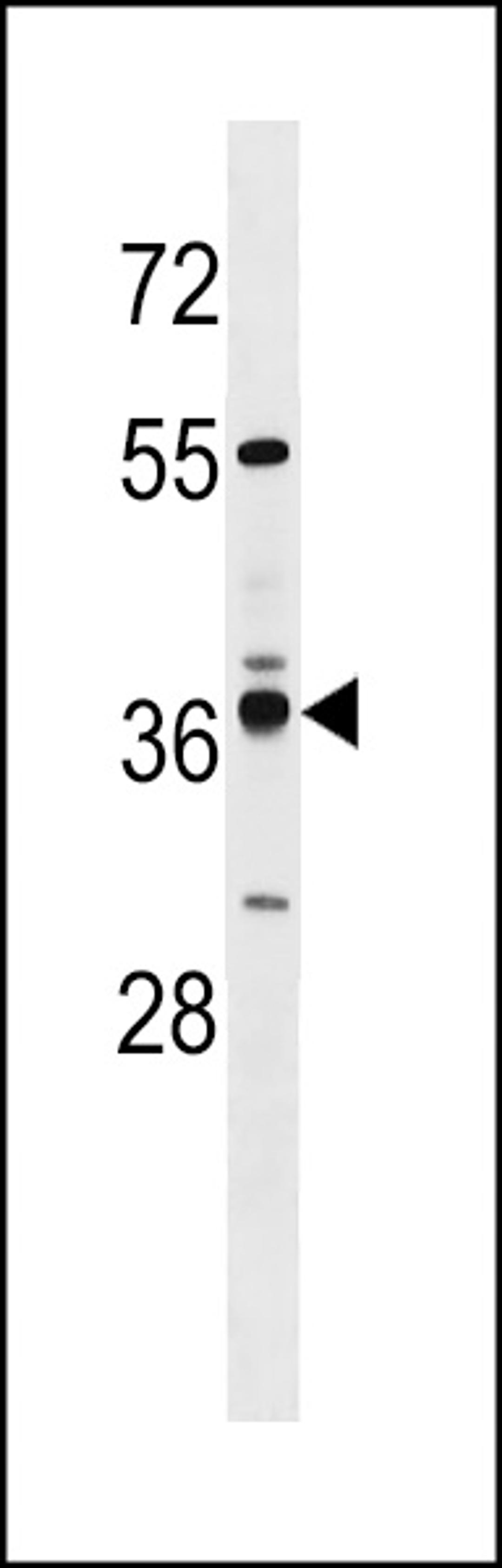 Western blot analysis in MDA-MB231 cell line lysates (35ug/lane).