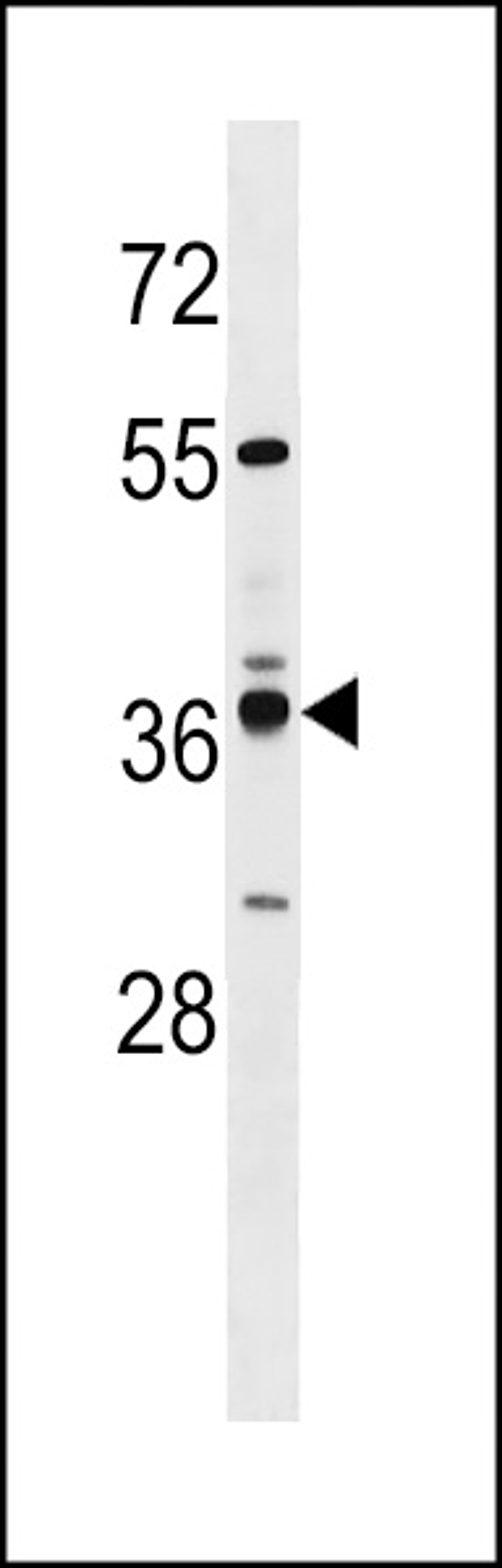 Western blot analysis in MDA-MB231 cell line lysates (35ug/lane).