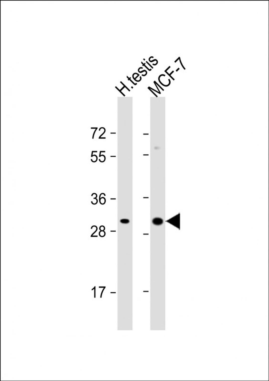 Western Blot at 1:1000 dilution Lane 1: human testis lysate Lane 2: MCF-7 whole cell lysate Lysates/proteins at 20 ug per lane.