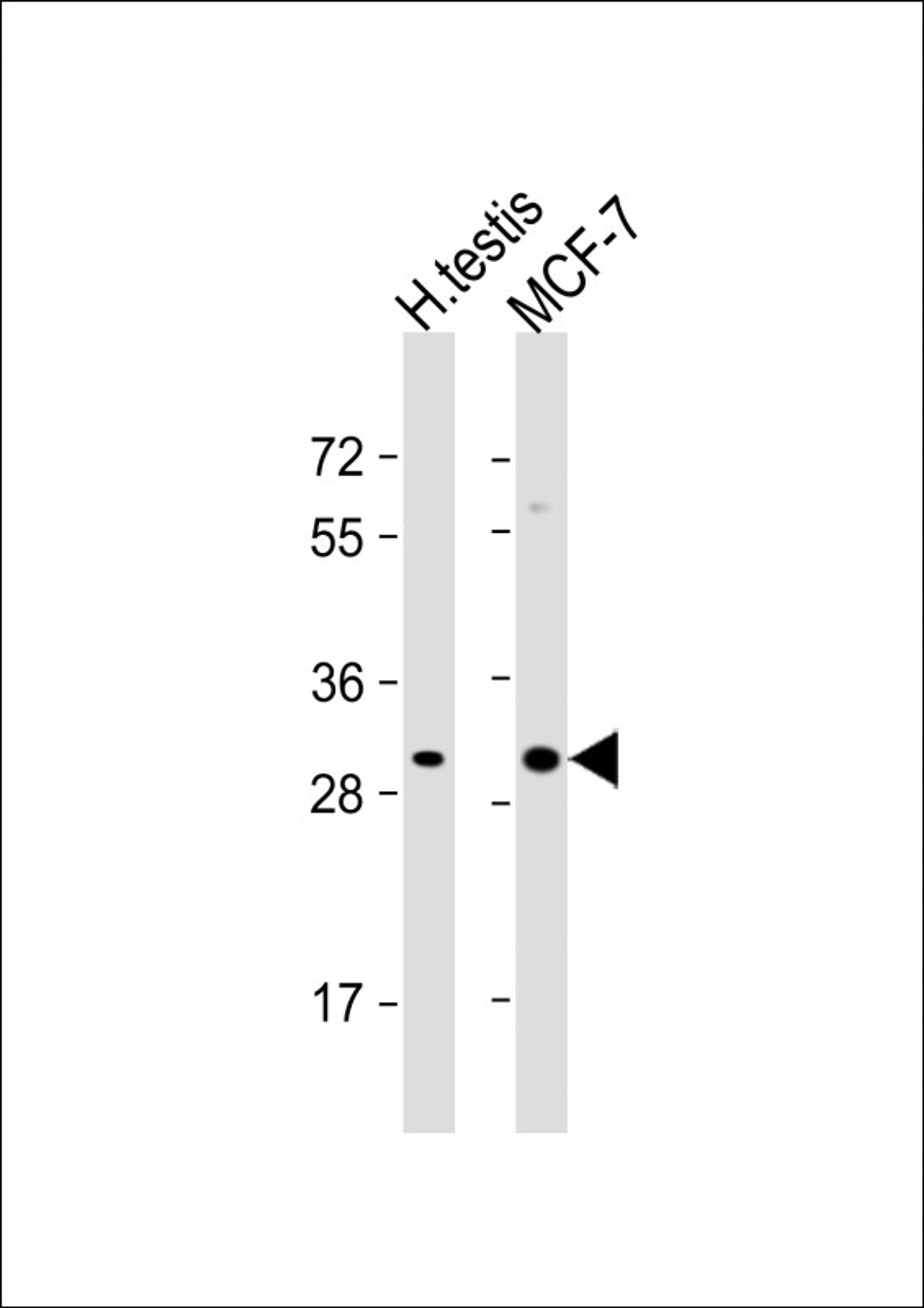 Western Blot at 1:1000 dilution Lane 1: human testis lysate Lane 2: MCF-7 whole cell lysate Lysates/proteins at 20 ug per lane.