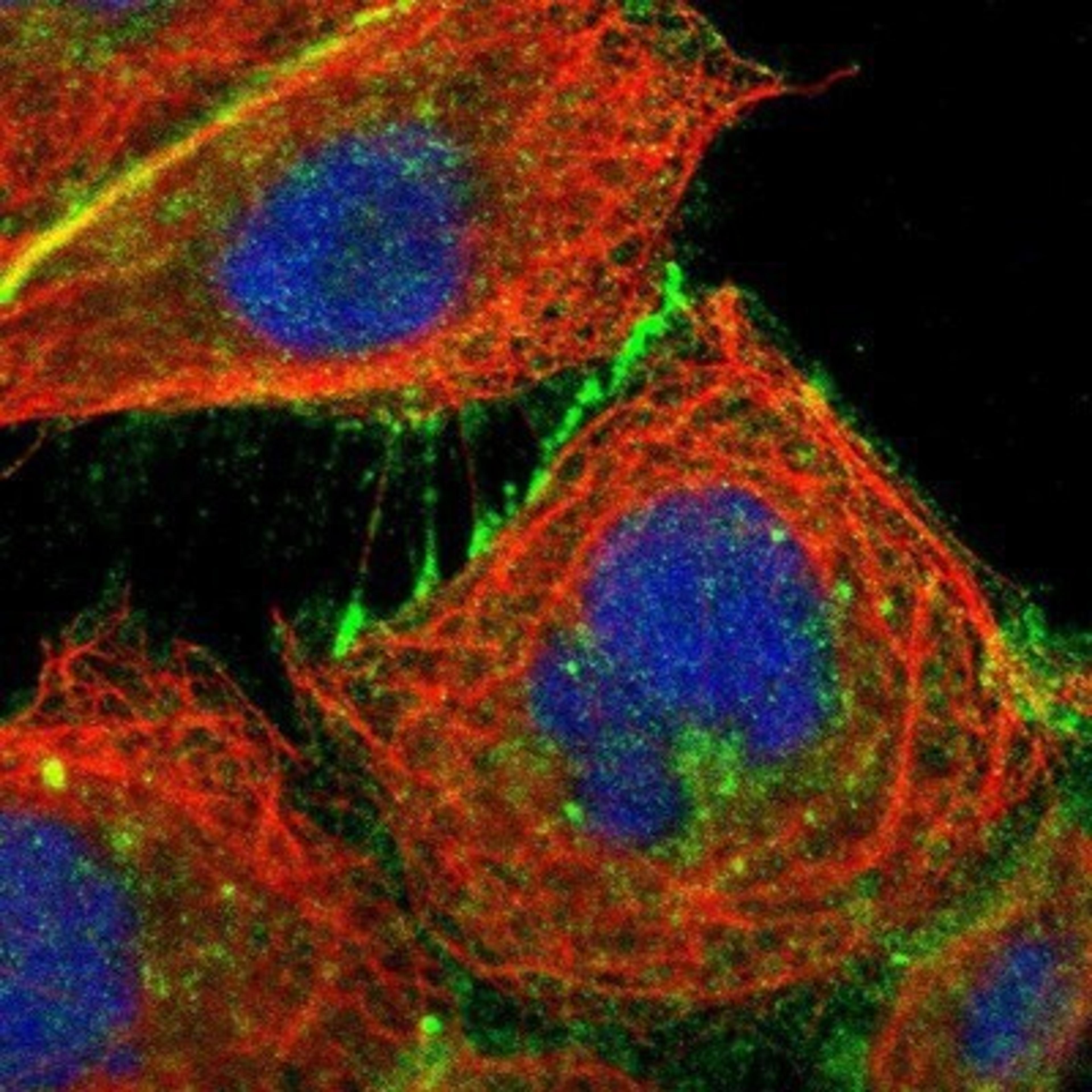 Immunocytochemistry/Immunofluorescence: Occludin Antibody [NBP1-87402] - Staining of human cell line A-431 shows positivity in plasma membrane & cell junctions.