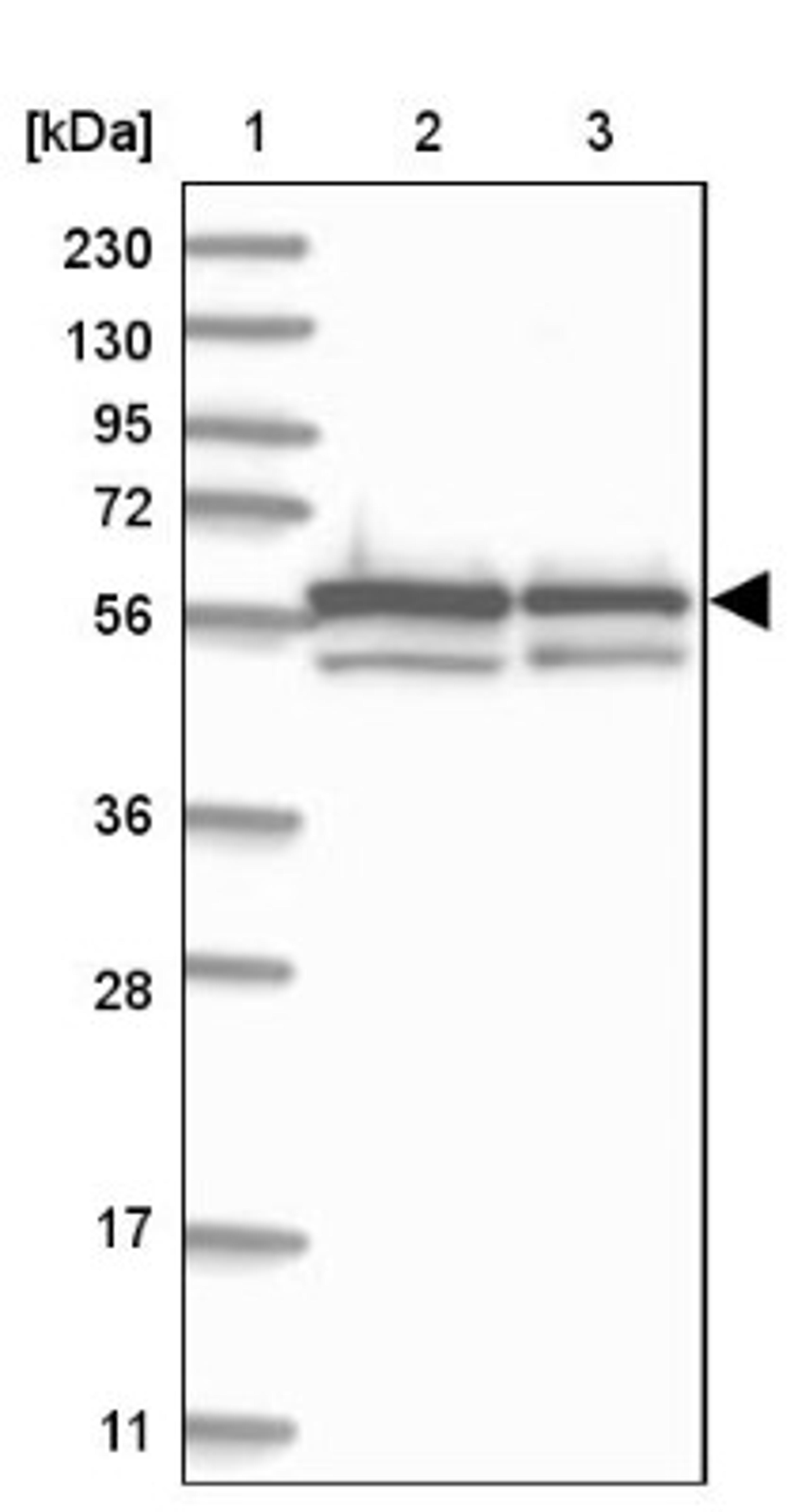 Western Blot: ZNF792 Antibody [NBP1-81936] - Lane 1: Marker [kDa] 230, 130, 95, 72, 56, 36, 28, 17, 11<br/>Lane 2: Human cell line RT-4<br/>Lane 3: Human cell line U-251MG sp