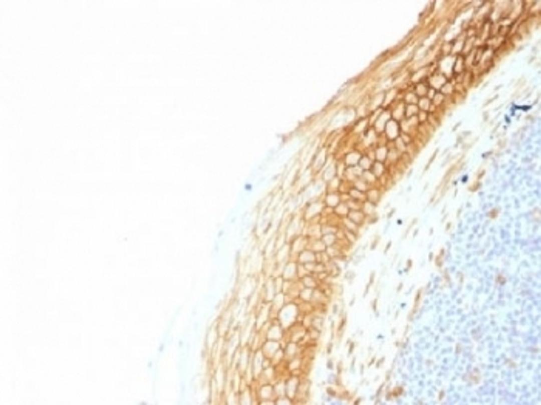 IHC testing of FFPE human tonsil tissue with Beta Catenin antibody (clone CTNNB1/1507). Required HIER: boil tissue sections in 10mM Tris with 1mM EDTA, pH 9.0, for 10-20 min.