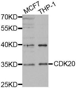 Western blot analysis of extracts of various cell lines using CDK20 antibody