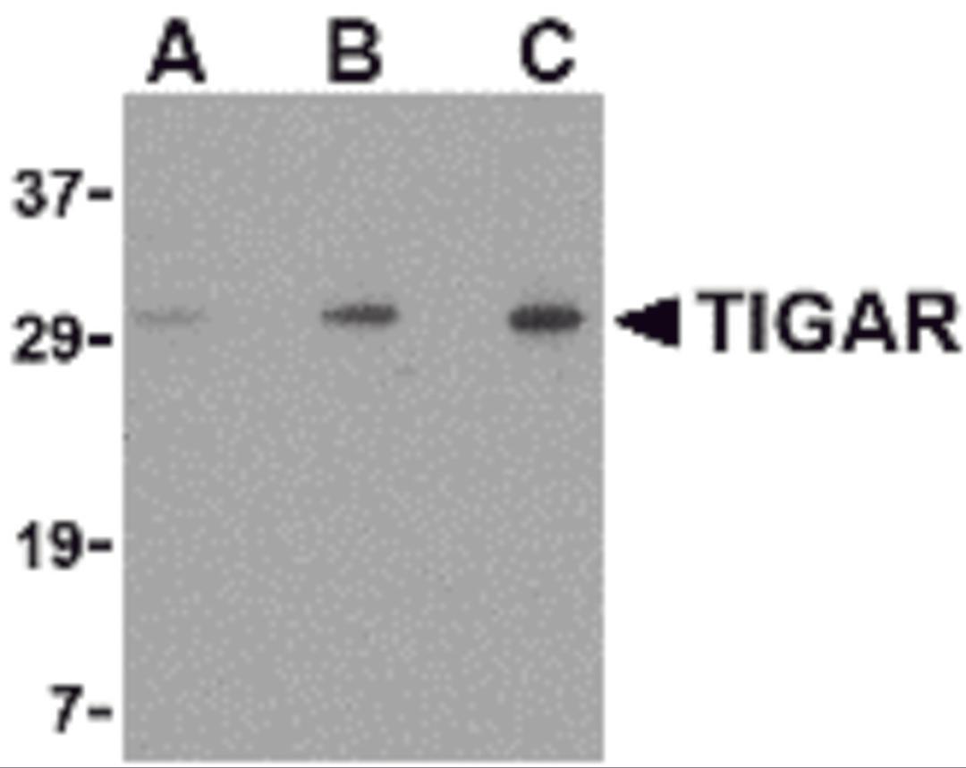 Western blot analysis of TIGAR in EL4 cell lysate with TIGAR antibody at (A) 0.5, (B) 1 and (C) 2 &#956;g/mL.