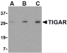 Western blot analysis of TIGAR in EL4 cell lysate with TIGAR antibody at (A) 0.5, (B) 1 and (C) 2 &#956;g/mL.