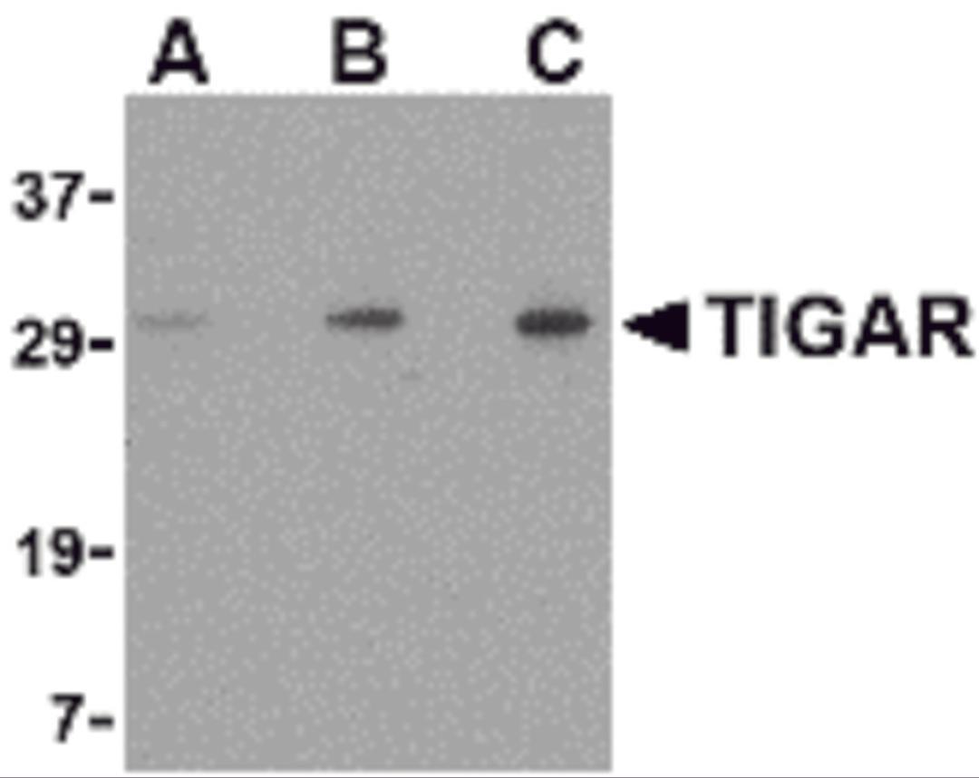 Western blot analysis of TIGAR in EL4 cell lysate with TIGAR antibody at (A) 0.5, (B) 1 and (C) 2 μg/mL.