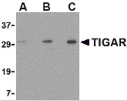 Western blot analysis of TIGAR in EL4 cell lysate with TIGAR antibody at (A) 0.5, (B) 1 and (C) 2 μg/mL.