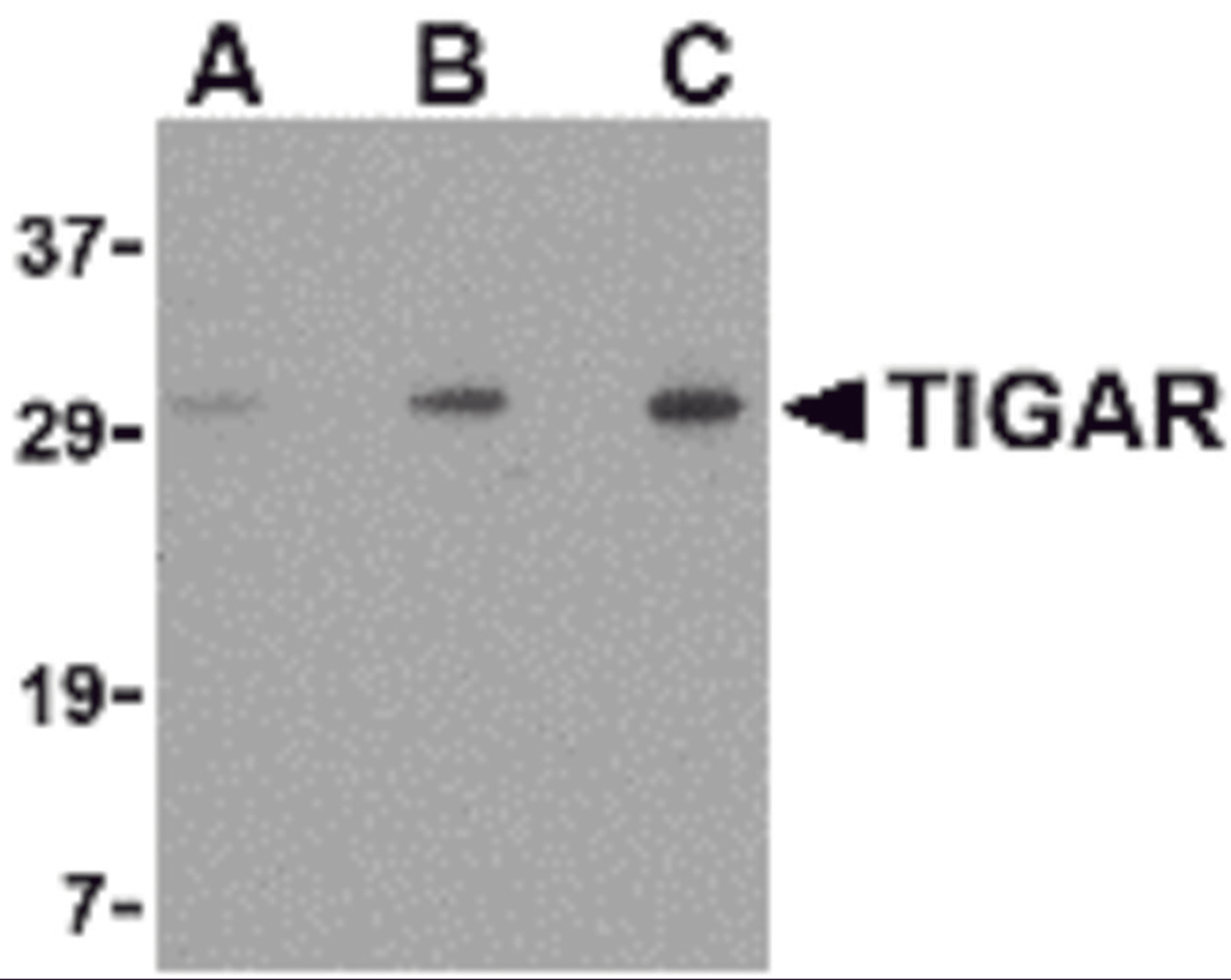 Western blot analysis of TIGAR in EL4 cell lysate with TIGAR antibody at (A) 0.5, (B) 1 and (C) 2 μg/mL.