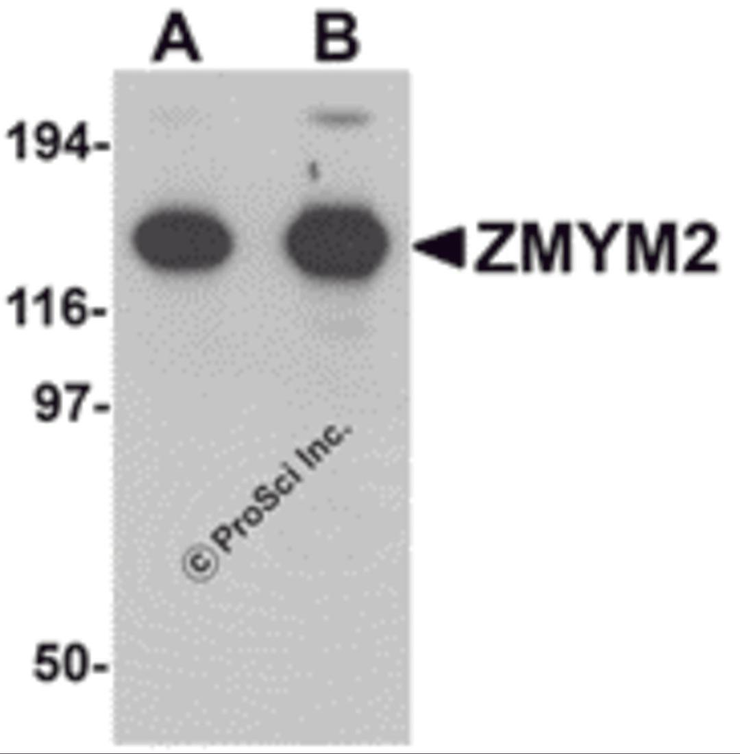 Western blot analysis of ZMYM2 in EL4 cell lysate with ZMYM2 antibody at (A) 0.125 and (B) 0.25 μg/mL.