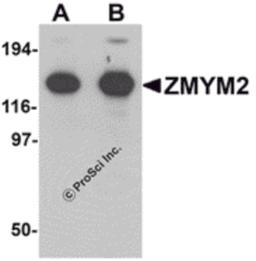 Western blot analysis of ZMYM2 in EL4 cell lysate with ZMYM2 antibody at (A) 0.125 and (B) 0.25 μg/mL.