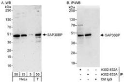 Detection of human SAP30BP by western blot and immunoprecipitation.