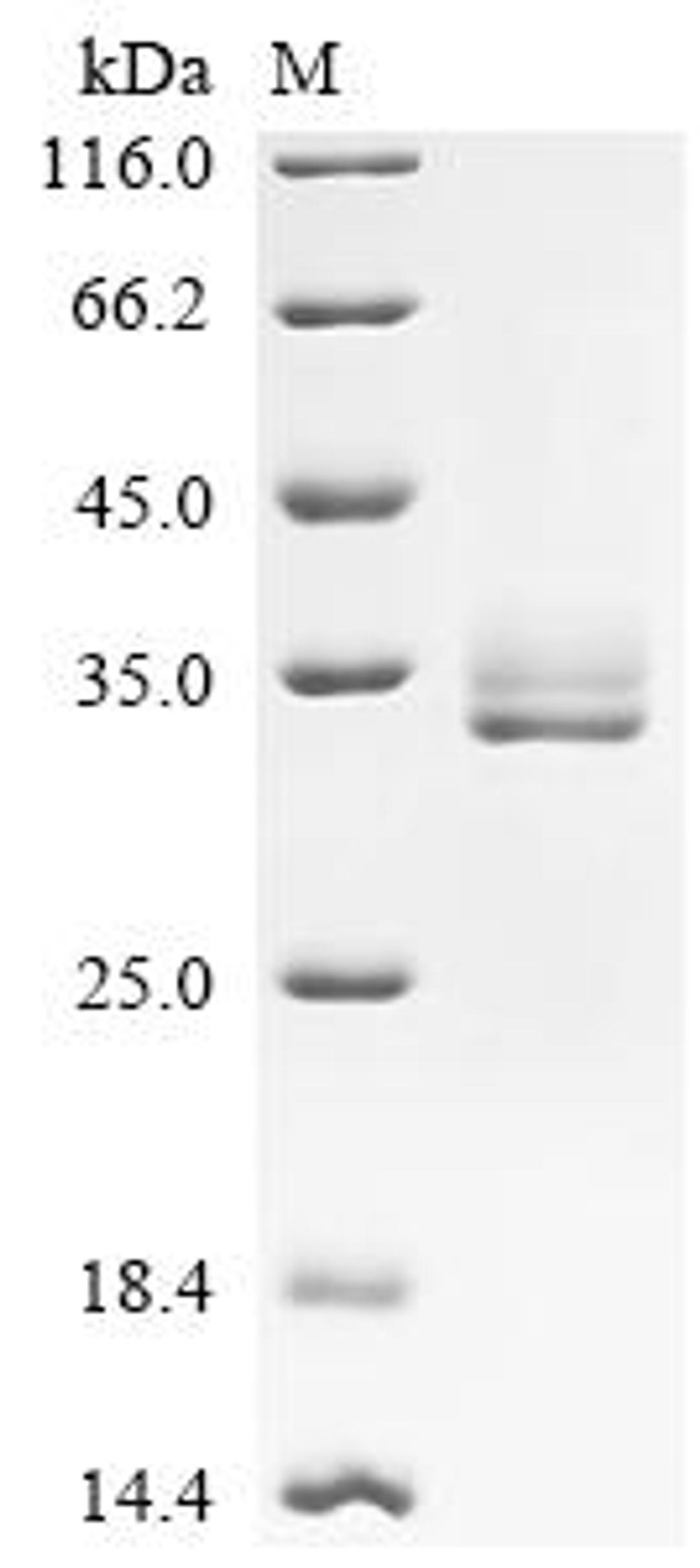 (Tris-Glycine gel) Discontinuous SDS-PAGE (reduced) with 5% enrichment gel and 15% separation gel.