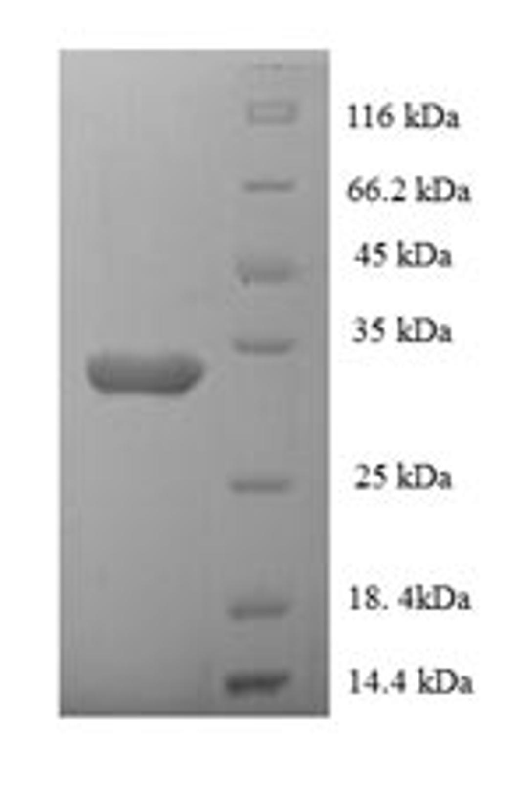 (Tris-Glycine gel) Discontinuous SDS-PAGE (reduced) with 5% enrichment gel and 15% separation gel.