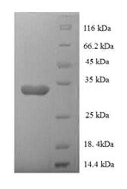 (Tris-Glycine gel) Discontinuous SDS-PAGE (reduced) with 5% enrichment gel and 15% separation gel.